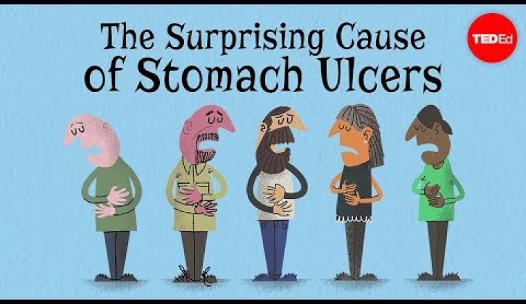 The Surprising Cause Of Stomach Ulcers