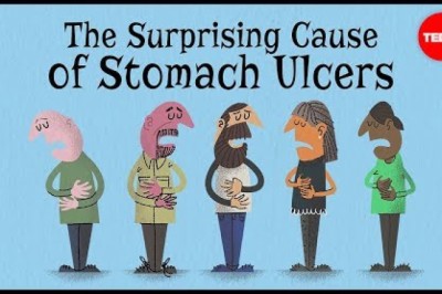 The Surprising Cause Of Stomach Ulcers