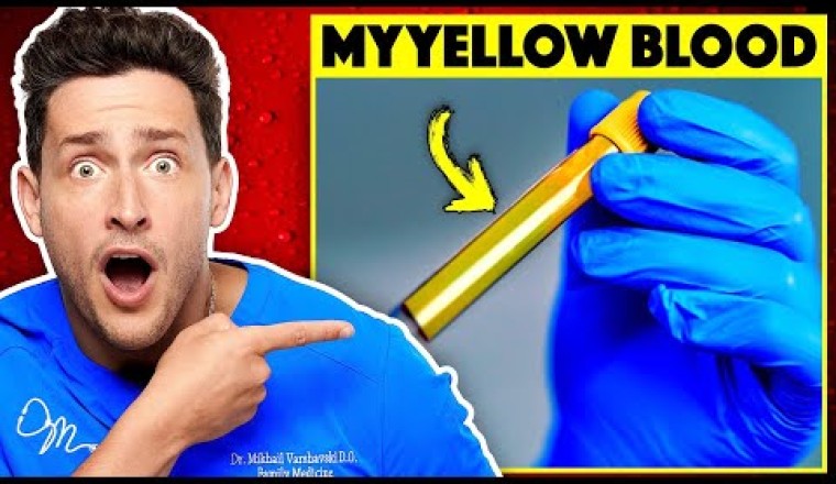 Here's Why My Blood Is Actually Yellow
