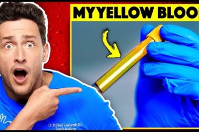 Here's Why My Blood Is Actually Yellow