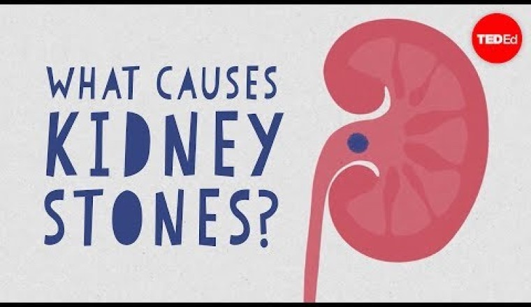 What causes kidney stones?