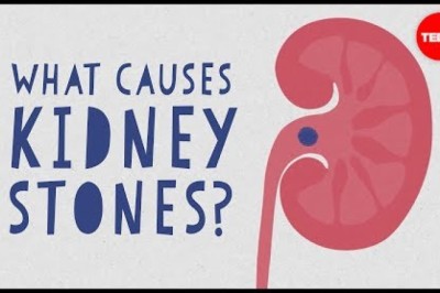 What causes kidney stones?