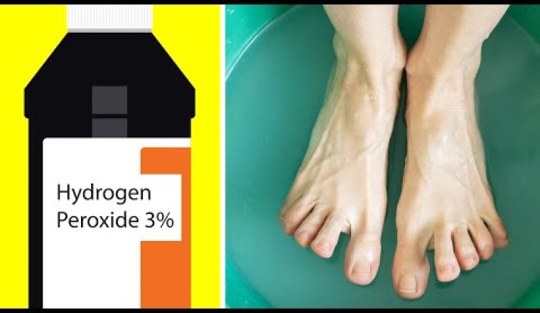13 Surprising Uses of Hydrogen Peroxide