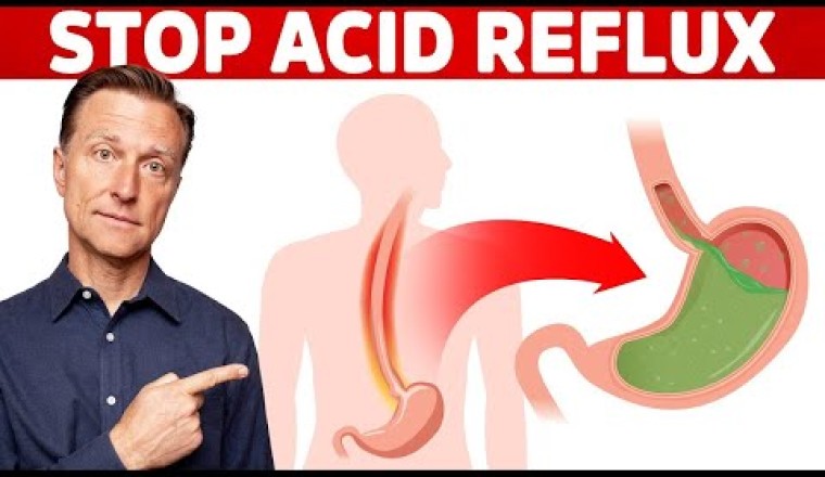 How to STOP Acid Reflux Instantly