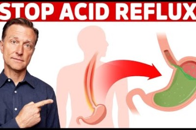 How to STOP Acid Reflux Instantly