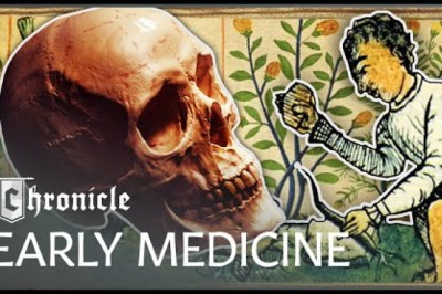 Why Was Indigenous American Medicine More Advanced Than Medieval Europe's?