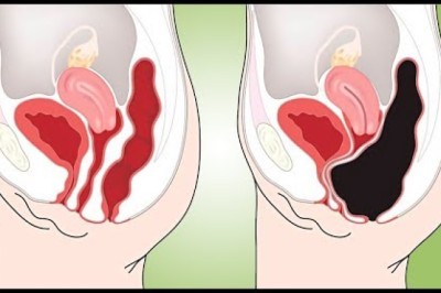 How to Cleanse Your Colon Naturally at Home (Colon Cleanse Smoothie)