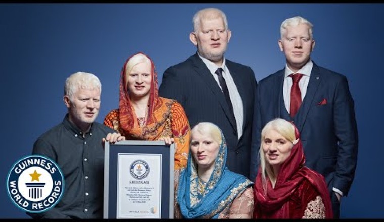 We're Asian, Albino and Beautiful