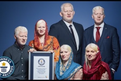 We're Asian, Albino and Beautiful