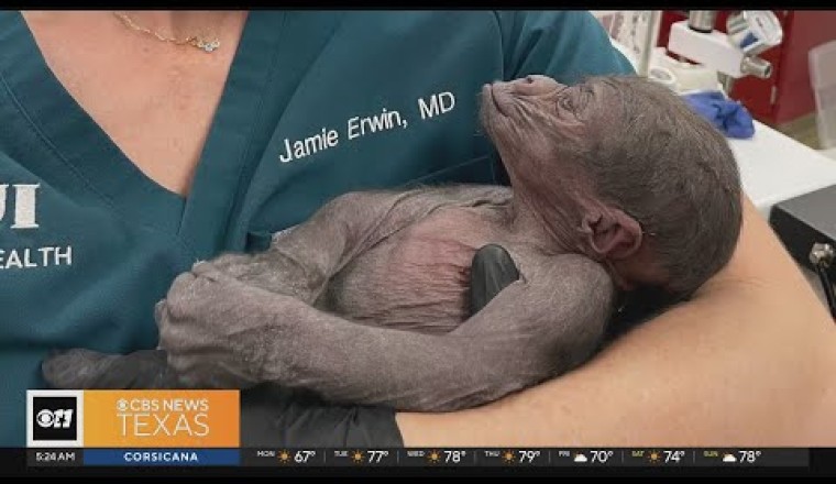North Texas OB-GYN Helps the Fort Worth Zoo With a Unique Situation