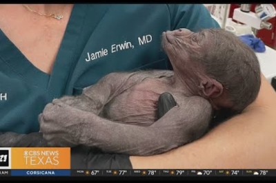 North Texas OB-GYN Helps the Fort Worth Zoo With a Unique Situation