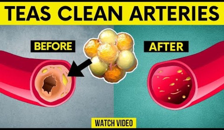 These 5 Teas Clean Arteries, Normalize High Blood Pressure and Prevent Heart Attack