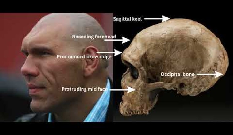 6 Neanderthal DNA Physical Traits in Modern Humans
