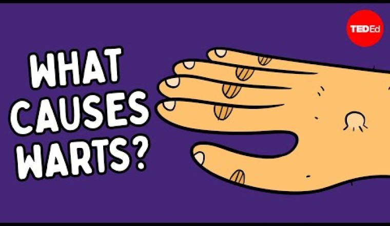 What Are Warts — and How Do You Get Rid of Them?