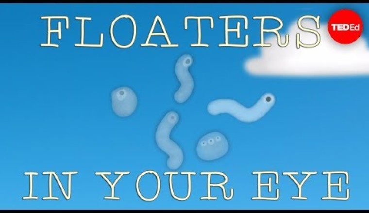 What Are Those Floaty Things in Your Eye?