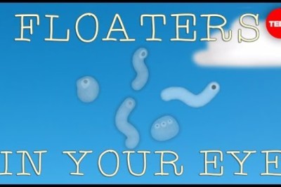 What Are Those Floaty Things in Your Eye?