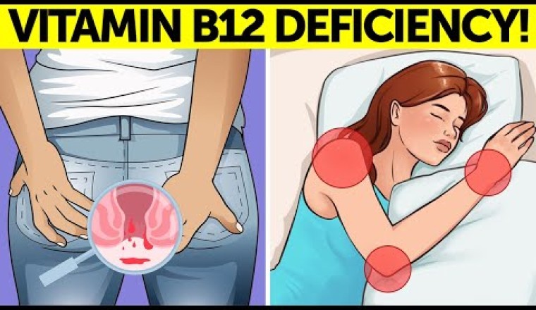 8 STRANGE Signs Your Body Is Begging for VITAMIN B12